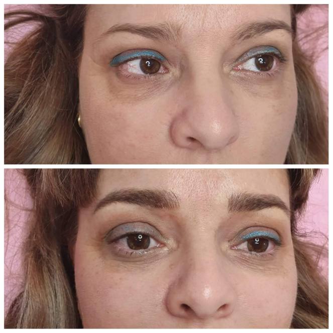 1D62CB3B-D99D-4BA6-B5FC-338C208537E0